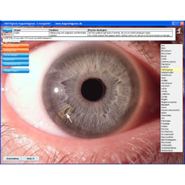 Digitale Augendiagnose DA8